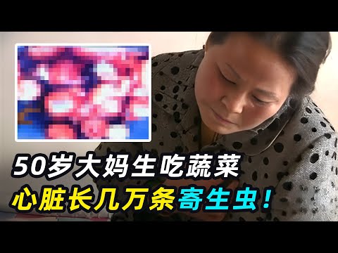 大妈喜爱生吃蔬菜，心脏长一串“葡萄”，医生切出上万寄生虫