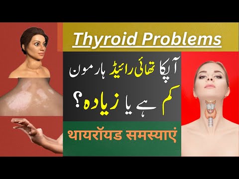 5 Warning Signs of Thyroid Problems | थायरॉयड समस्याएं #gravesdisease #drabbasofficial