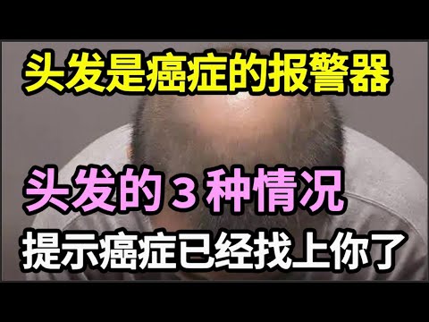 头发是癌症的报警器，医生提醒：头发的3种情况，提示癌症已经找上你了，每个人都应该要知道【家庭大医生】