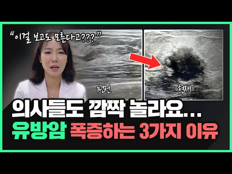 요즘 유방암이 폭증하는 진짜 이유...ㄷㄷ | 유방암에 걸리지 않으려면 '이것'만큼은 제발 하지마세요!!!