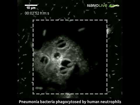 Label-free live cell imaging of pneumonia bacteria phagocyted by neutrophils