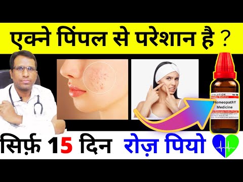 Unlock Clear Skin Discover the 4 Best Homeopathic Medicines for Acne Pimple Now