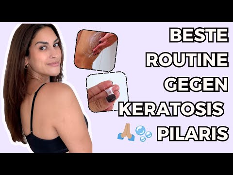 KERATOSIS PILARIS ROUTINE 💙 SO bin ich es losgeworden 🥹 REIBEISENHAUT Behandlung | Angela Mel