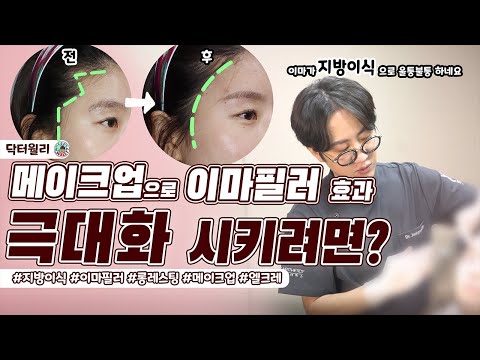 이마 필러와 헤어라인, 눈썹 제모를 하루에??! 동시에 하면 어떤 변화가 있을까요?