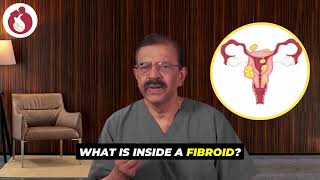 What Is Inside a Fibroid? Non Surgical Treatment of Uterine Fibroids | HIFU For Fibroids | Dr Selva