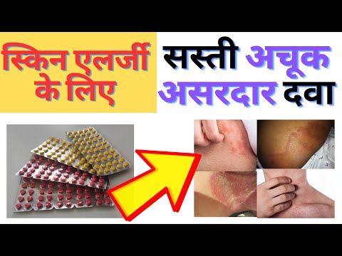 स्किन एलर्जी के लिए सस्ती अचूक और असरदार दवा | Actazine Tablets | How To Get Ride Of Itching