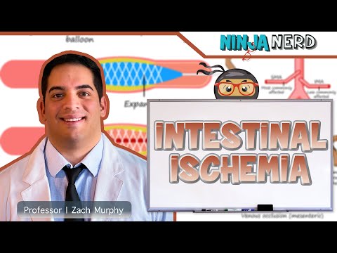 Intestinal Ischemia | Clinical Medicine