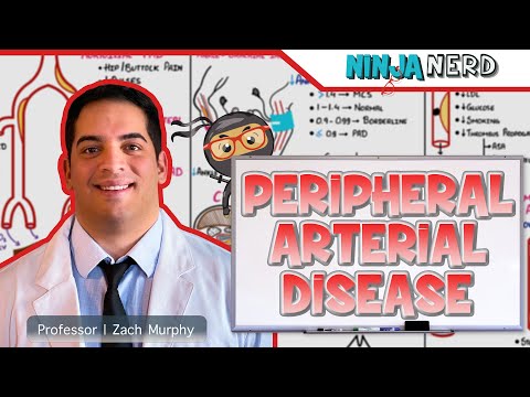 Peripheral Arterial Disease | Clinical Medicine