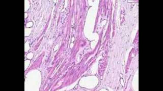 Shotgun Histology Female Urethra