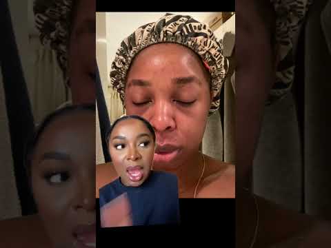 How I transformed my skin. #adultacne #blackgirlskin #acneproneskin #acnetreatment