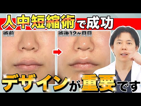 人中短縮術で成功するにはデザインが重要な理由【美容医療】