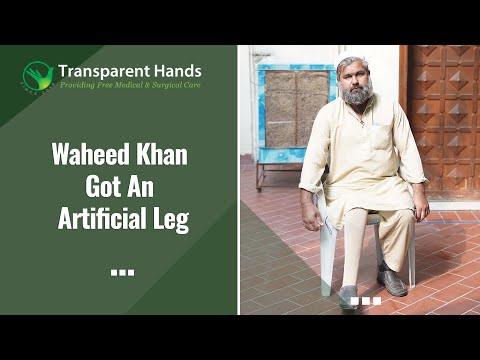 Waheed Khan’s Artificial Leg was Fixed