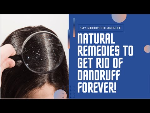 Dandruff Treatment at Home | How to get rid of Dandruff | Dandruff Removal | Itchy scalp