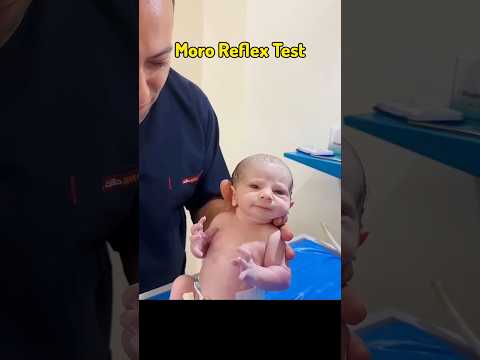 Moro Reflex Test #facts #tamilshorts #educationalvideo #science