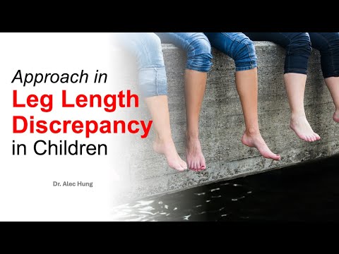 Approach in Leg Length Discrepancy in Children by Dr Alec Hung - 5 April 2024