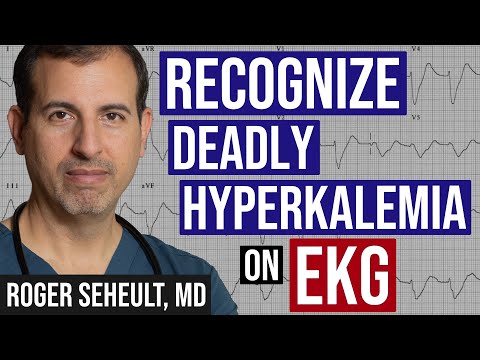 Hyperkalemia - Peaked T-Waves - and ECG Recognition