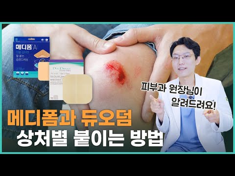 메디폼 VS 듀오덤 차이, 내 피부에 맞는 제품으로 어떤 걸 쓸까?