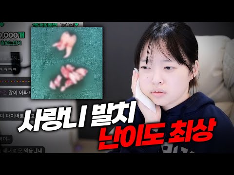 사랑니 4개 한번에 뺌 야발