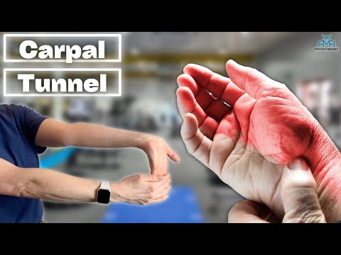 The BEST Treatments For Carpal Tunnel Syndrome!