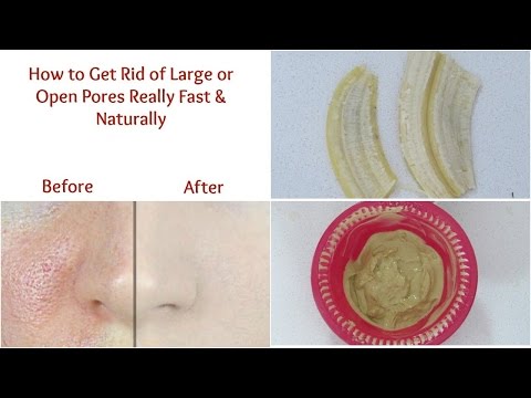 Get rid of large or open pores really fast | Get smooth fairer skin