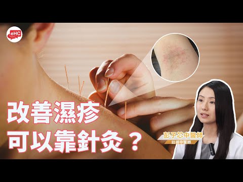 皮膚｜改善濕疹可以靠針灸?