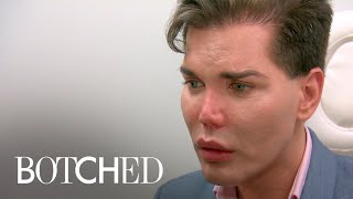 Dr. Paul Nassif Says Patient's Nose "Could Fall Off" | Botched | E!