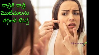 how to remove pimples on face naturally at home |  Remedies for acne and pimples at home