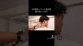 いいリアクション😂　#鍼治療　#首コリ #リアクション動画