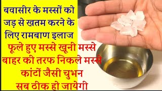 bawaseer ka ilaj,elaj,bawaseer ki dawai,bawaseer ke masse, बवासीर के मस्सों का इलाज (home remedy)