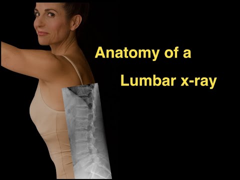 Anatomy of a Lumbar x-ray