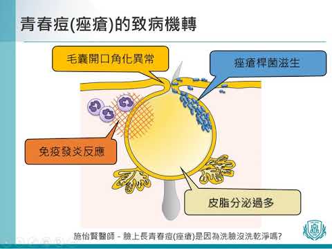 28 施怡賢醫師 青春痘痤瘡是洗臉沒洗乾淨造成的嗎