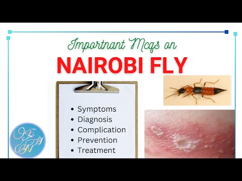 Nairobi Fly MCQs questions with answers।। Detailed epidemiology (symptoms, Complication, Treatment)