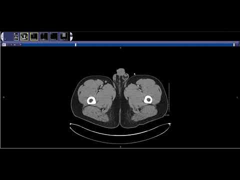 How to read and Abdominal and Pelvis CT