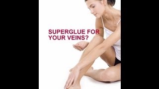 VenaSeal - 3 Reasons You Might Choose Superglue for Your Veins