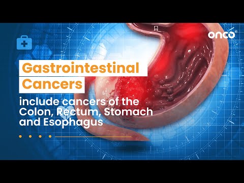 #GISTAwarenessDay: Foods to eat & avoid during gastrointestinal cancers | English | Onco Cancer Care