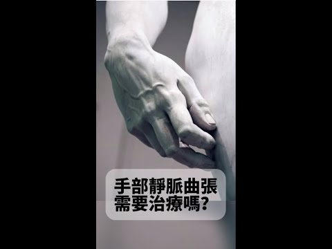 手部靜脈曲張，需要治療嗎 ?