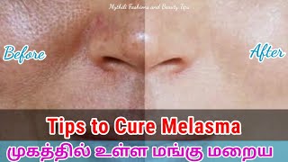 Natural Ingredients to Get Rid of Melasma | Pigmentation Tips | Tips for Black Spots | Mythili Tips