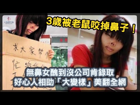 3歲被老鼠咬掉鼻子！無鼻女沒公司肯錄取，好心人相助「大變樣」美翻全網【人生勝利組】