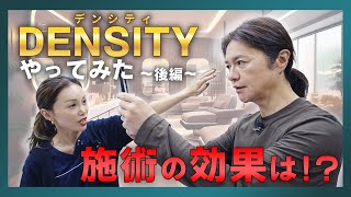 【やってみたシリーズ】話題のDENSITY(デンシティ)、施術後の効果を公開！！DENSITYやってみた ～後編～！