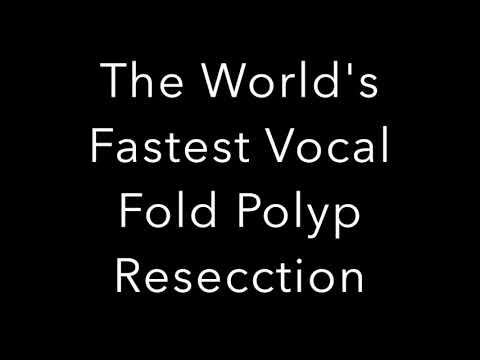 The World's Fastest Vocal Fold Polyp Resection