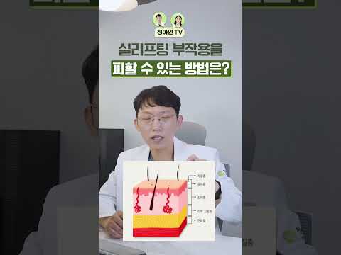 실리프팅, 부작용 없이 시술하는 방법