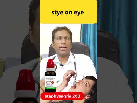 stye on eye #shorts #health #healthtips #gyan #shortvideo #viral #facts #food