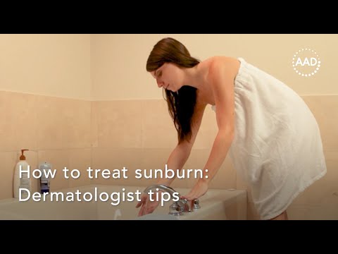 How to treat a sunburn: Dermatologist tips