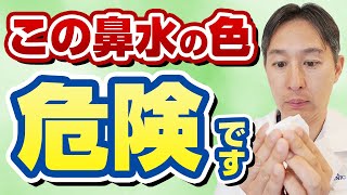 鼻水が止まらない人へ、色から鼻炎を見分ける方法７選