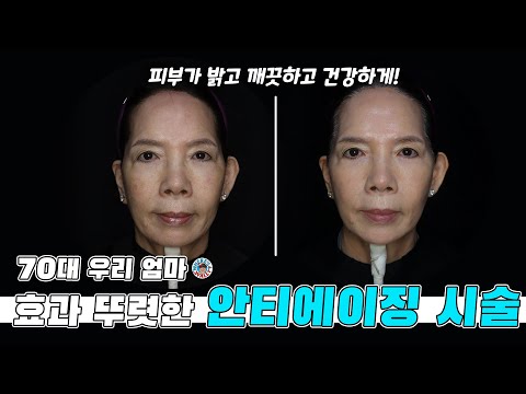 의사 딸을 둔 어머니는 이런 시술로 피부가 젊어져요