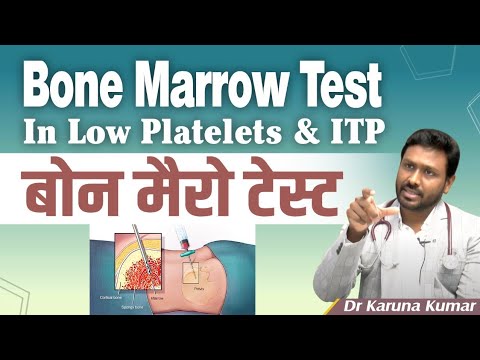 Bonemarrow Test in Low Platelets and ITP | Diagnosis of ITP | Dr Karuna Kumar | Hematologist