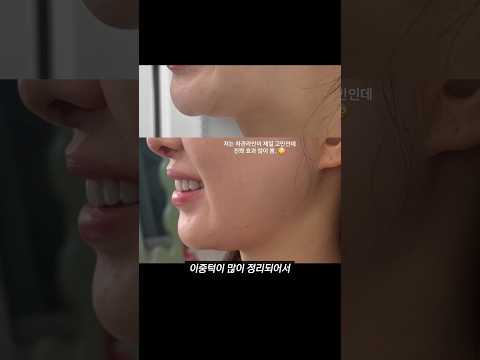 이중턱고민이면 따라해보세요!!! 효과봄!!ㅣ아랑 #세라매스