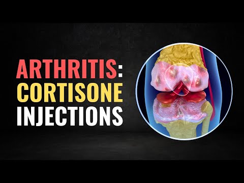 Why Cortisone Shots for Knee Arthritis Might Be Wrong For You