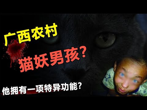 广西惊现“猫眼男孩”，夜间拥有蓝眼透视，村民：被猫妖附身？