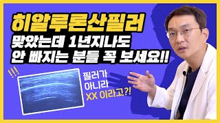 히알루론산필러! 1년정도 유지되고 녹는필러라고 해서 맞았는데 볼륨이 안 줄어든다고?!